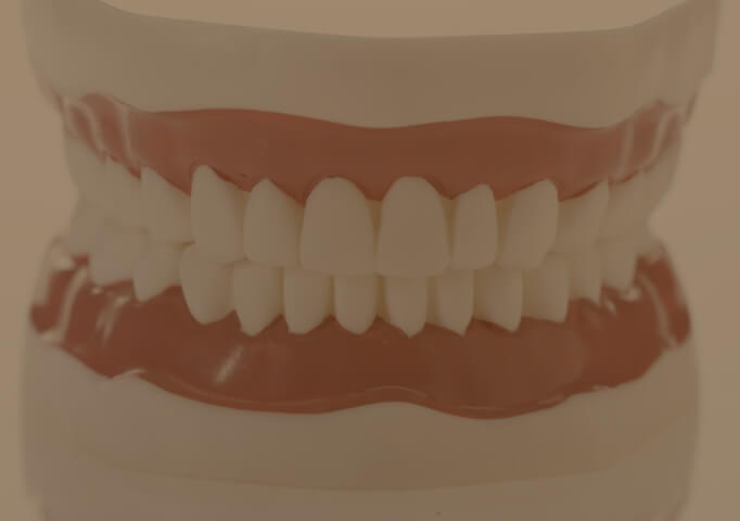 審美治療・ホワイトニング